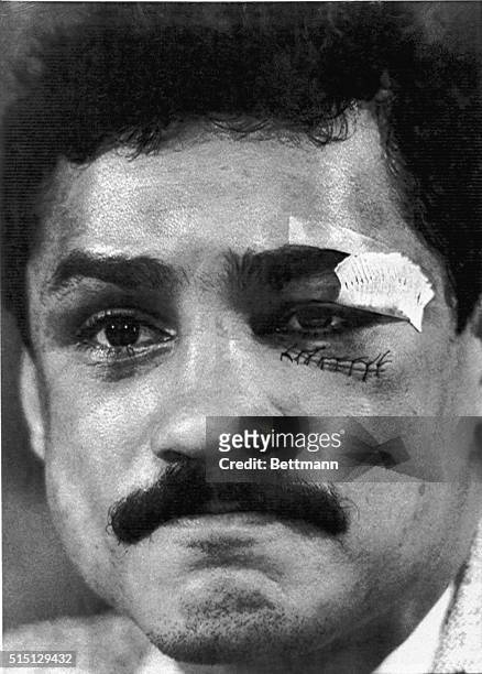 November 15, 1982-Miami, Florida: Alexis Arguello, who lost his bid to win the Junior Welterweight title from Aaron Pryor November 12th, attends a...