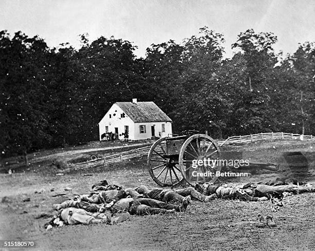 Some of the casualties from the Civil War Battle of Antietam, September 17, 1862. Total casualties for the day were 2,700 Rebels and 2,108 Federals....
