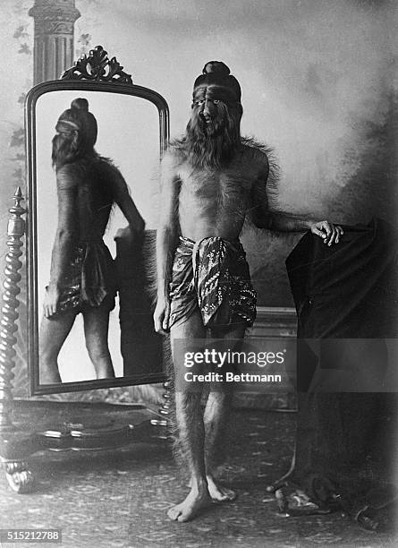 Full length standing portrait of Noung Phaset, member of Burmese "hairy family." The young man has heavy hair growth all over his body, especially on...
