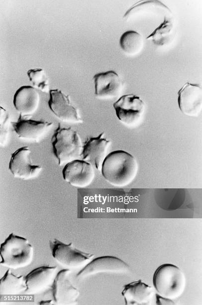 Deoxygenated Raspberry 50 What Is Deoxygenated Blood Stock Photos, High-Res Pictures, and ...