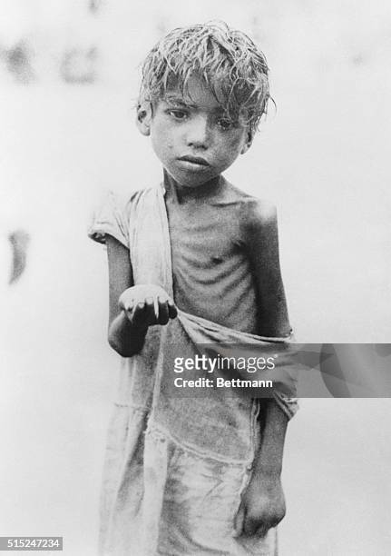 Calcutta: Pitiful Skeleton Of a Child Begging For Food. This tragic child, victim of the famine that has spread throughout India, is shown begging...