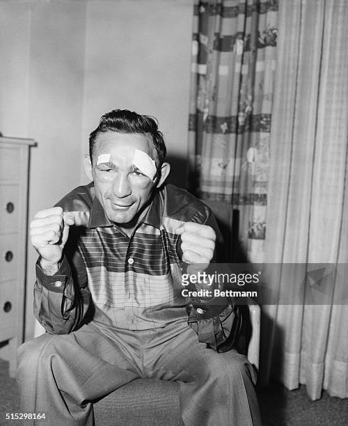 New York, NY- A closeup of middleweight champion Carmen Basilio with patches above his eyes after he was stiched up by a doctor. Carmen, who's shown...