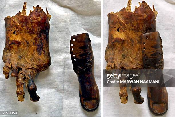 Combo picture of two images taken 13 August 2002 at Cairo Museum shows a foot of a mummy missing its big toe and beside it a prosthetic toe of...
