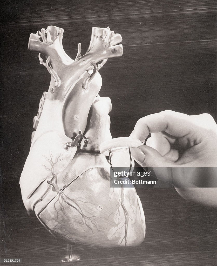 Close-Up of Artificial Heart Valve
