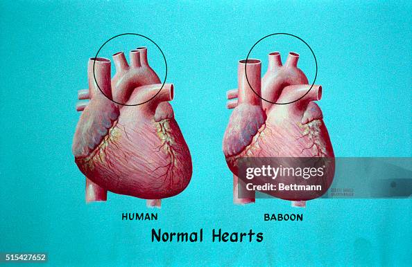 Human and Baboon Normal Hearts Human and Baboon Normal Hearts