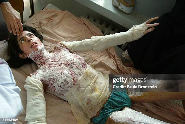 Parigul, 22-yeras-old, who suffers from severe burns on over 50% of her body from self-immolation, is covered in antiseptic burn cream as she lies in...