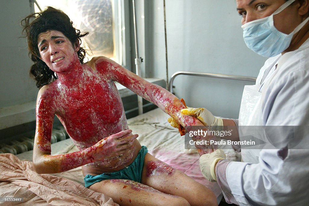 Desperation Drives Women To Self Immolation In Herat