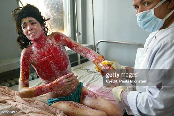 Parigul, 22-yeras-old, who suffers from severe burns on over 50% of her body from self-immolation, has iodine rubbed on her raw skin at the Herat...