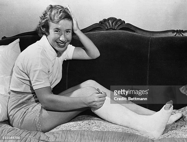 Maureen Connolly, U.S. Tennis champion and holder of too many women's tennis titles to recount, is shown at home with her leg in a cast after...