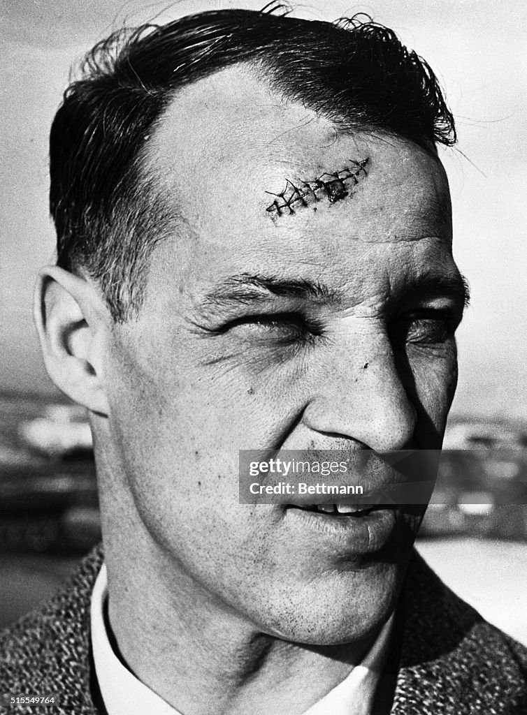 Gordie Howe With Stitches in Head