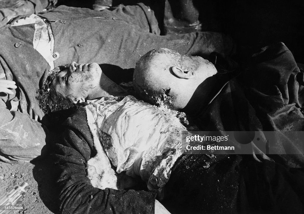 Bodies Of Benito Mussolini And Mistress