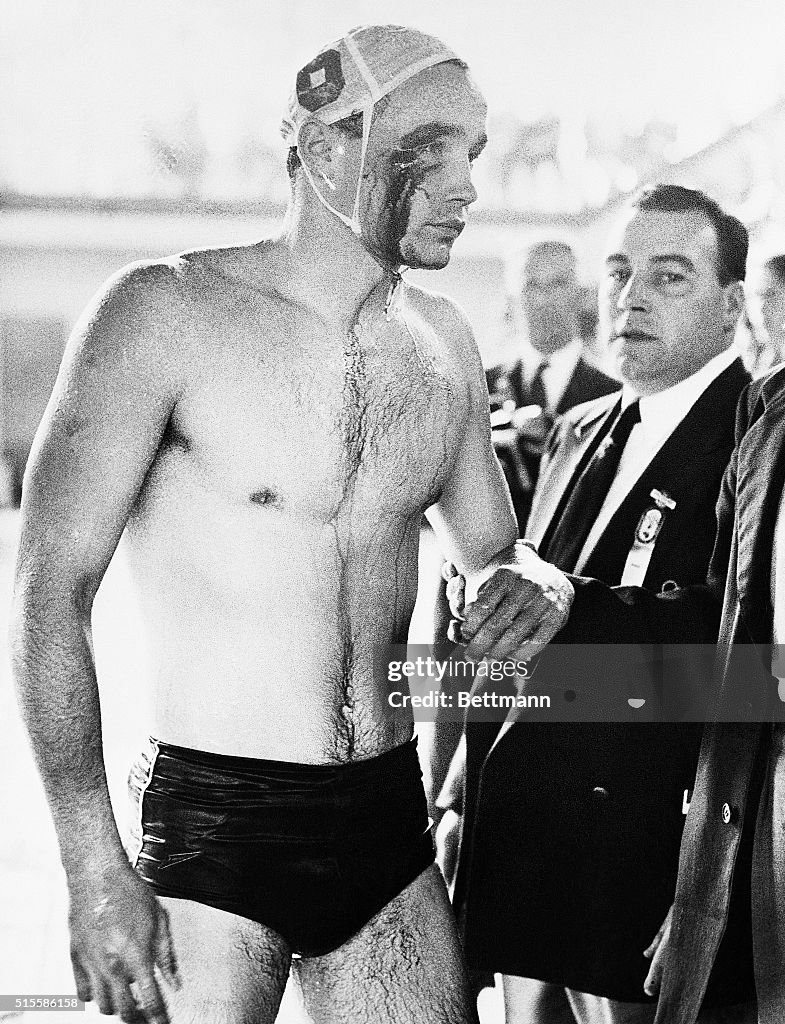 Water Polo Player Bleeding From Face