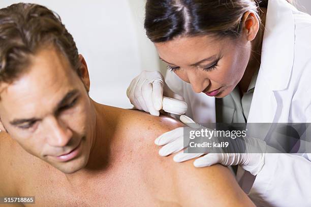 dermatologist examining patient's skin for signs of cancer - skin stock pictures, royalty-free photos & images