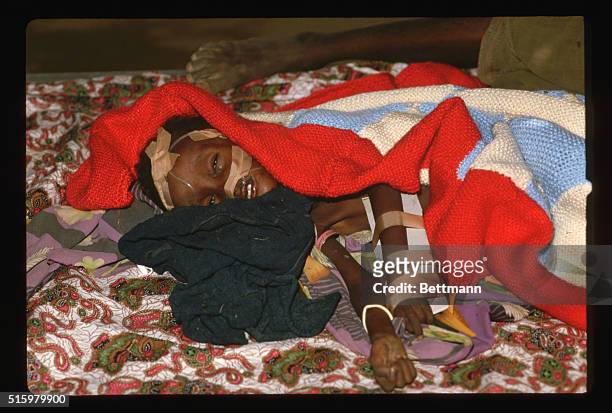 Kassala, SudanA severly starving child lies under a blanket with IV feeding tubes running into him at the Wad Sharifee refugee camp outside of...