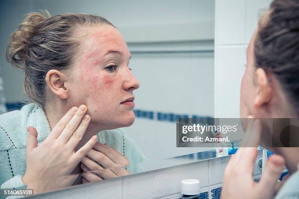 oh díos mío, ¿ qué es esto? - picor fotografías e imágenes de stock