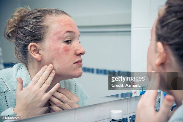 oh my god, what is that? - human skin stock pictures, royalty-free photos & images