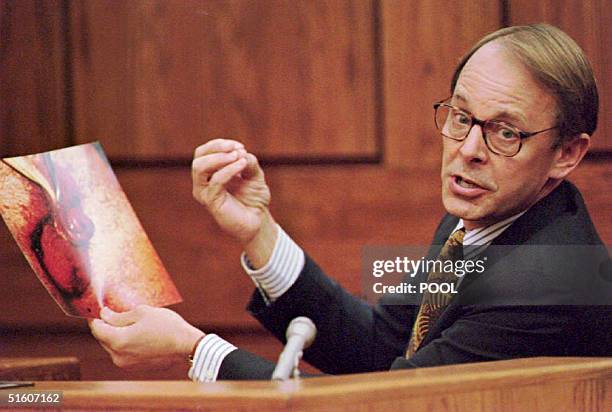 Dr. James T. Sehn holds a photo of the severed penis of John Wayne Bobbitt during the second day of the trial of Lorena Bobbitt in the Prince William...