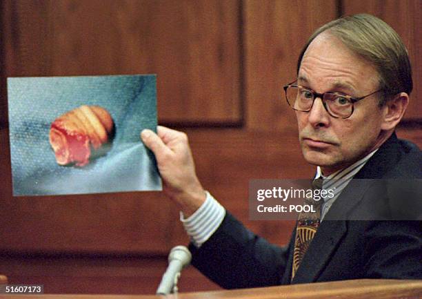 Dr. James T. Sehn holds a photo of the severed penis of John Wayne Bobbitt during the second day of the malicious wounding trial of Lorena Bobbitt in...