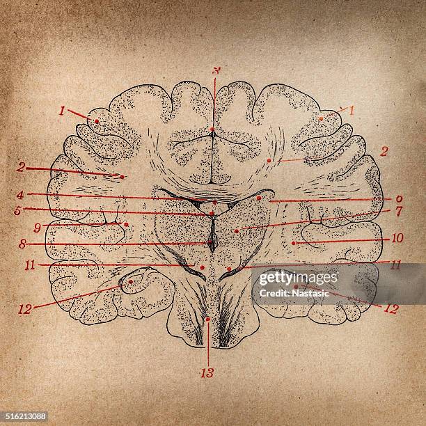 gehirn-abschnitt - gehirnchirurgie stock-grafiken, -clipart, -cartoons und -symbole