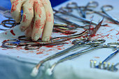 Surgeon's hand and bloody tools
