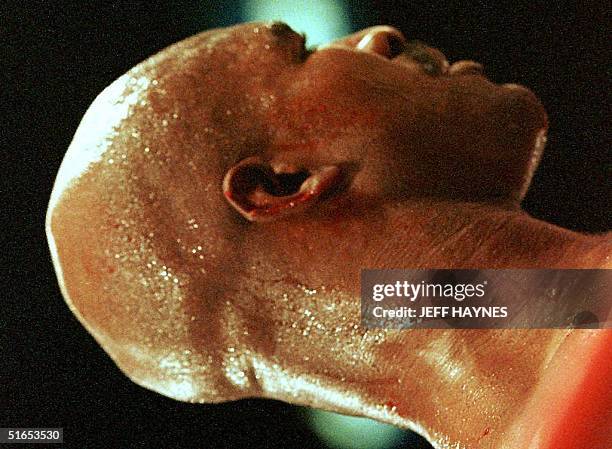 Evander Holyfield stands in the ring after Mike Tyson bit his ear 28 June during his WBA heavyweight championship fight against Mike Tyson at the MGM...