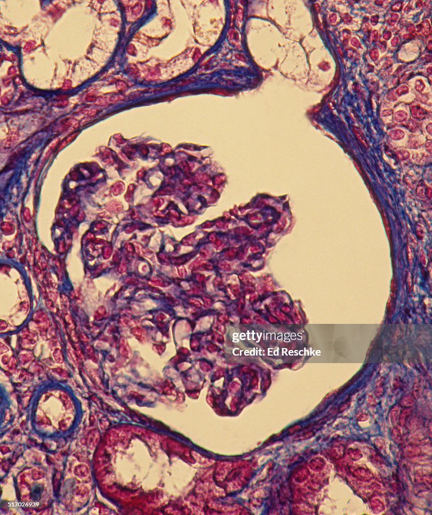 Kidney Nephron--Glomerulus, Glomerular Capsule