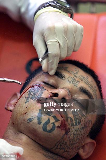 Doctor aids a fallen gang member in Santa Ana, El Salvador 19 February 2002. Un medico del Hospital San Juan de Dios sutura una herida en el rostro...