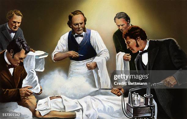 Joseph Lister directing use of carbolic acid spray in one of his earliest antiseptic surgical operations, circa 1865.