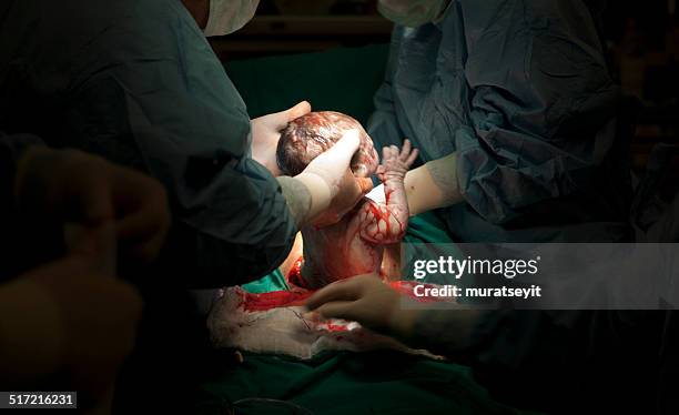 cesarean - caesarean section stock pictures, royalty-free photos & images