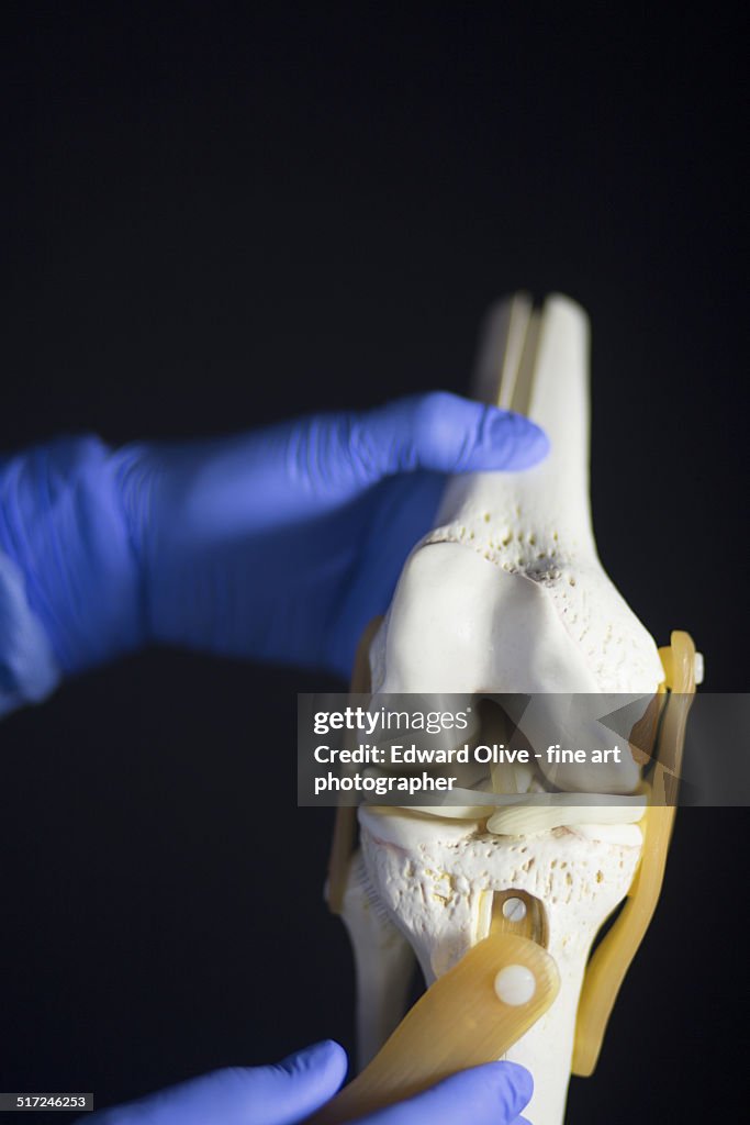 Doctor demostrating knee joint meniscus model