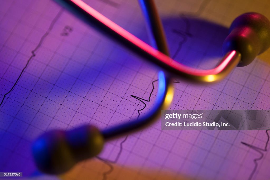 ECG graph and stethoscope