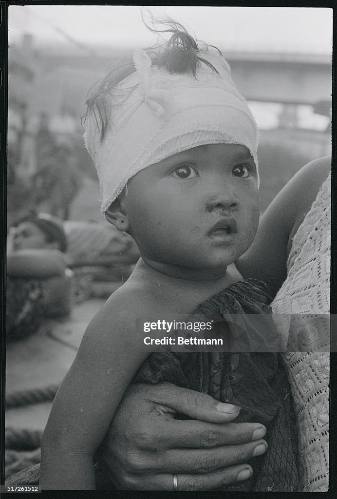 Bandaged Baby Waiting with Mother