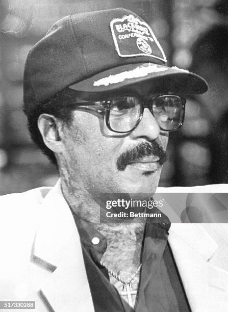 Burbank, California: Comedian Richard Pryor, who nearly died in a freak fire at his home three months ago, tells a nationwide TV audience 9/5, that...