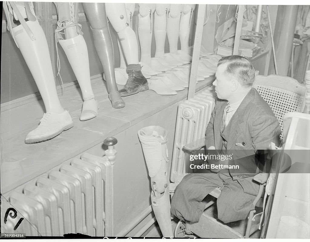 Exploding Limb Man New York Institute For Crippled And Disabled. The disabled man goes ...
