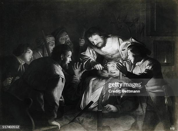 Gerard van Honthorst painting of a dentist in the middle of surgery which was on display at the Pierre Lichtenstien Gallery in Vienna.