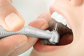 Close up of dentist hand drilling the teeth and spraying