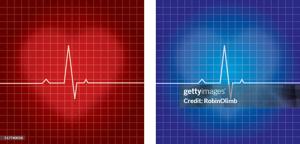 Heartbeat Monitor Vector Heartbeat Monitors High-Res Vector Graphic - Getty Images