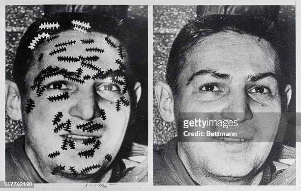 With the help of the artist's brush, Detroit Red Wings' Gordie Howe and Terry Sawchuck are shown with every facial cut they have suffered in 14 years...