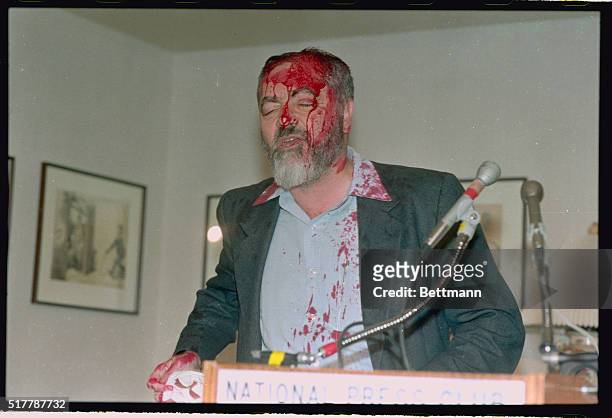 Washington: During a speech at the National Press Club, Rabbi Meir Kahane, was doused with a red substance by a man identified himself as Daniel...