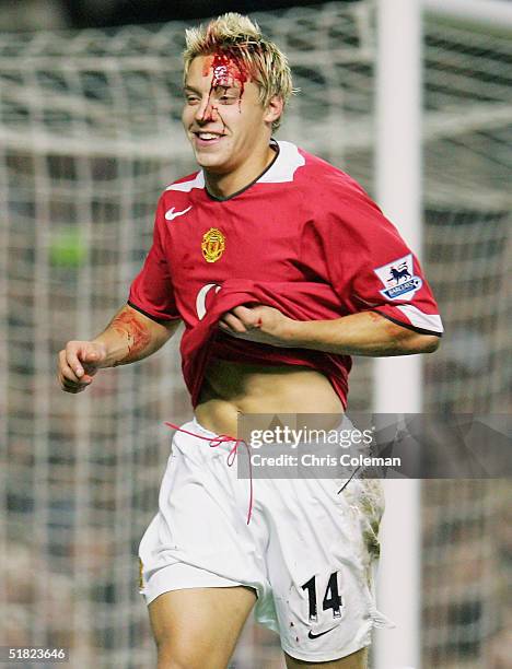 Alan Smith of Manchester United leaves the pitch with a bloody face during the Barclays Premiership match between Manchester United and Southampton...