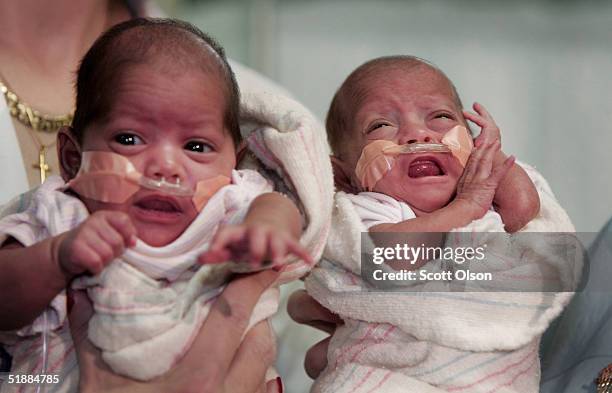 Rumaisa Rahman is held next to her fraternal twin sister Hiba by a nurse as they are introduced to the press at Loyola University Medical Center...