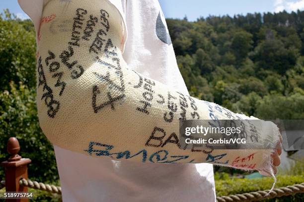 close up a broken arm in a cast covered with signatures - close up of arm in cast stock-fotos und bilder