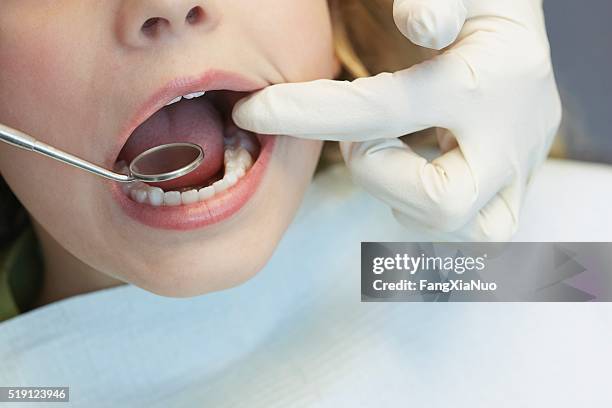 niño que se hace un examen dental - dientes fotografías e imágenes de stock