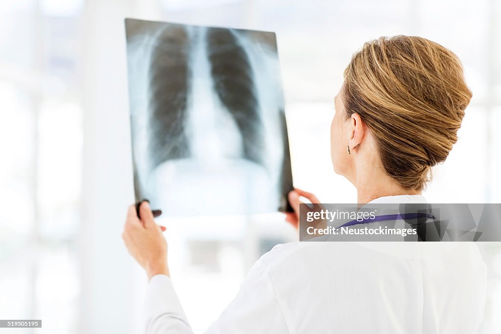 Médecin examiner poitrine X-Ray à l'hôpital