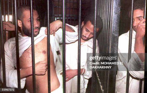 Suspected Islamic militant Mohamed Mawad shows 06 December 1994 bruises he claims come from brutal treatment in jail at the military court in Cairo....