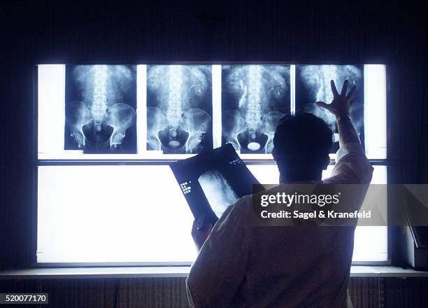 doctor looking at roentgenograms - panel de luz fotografías e imágenes de stock