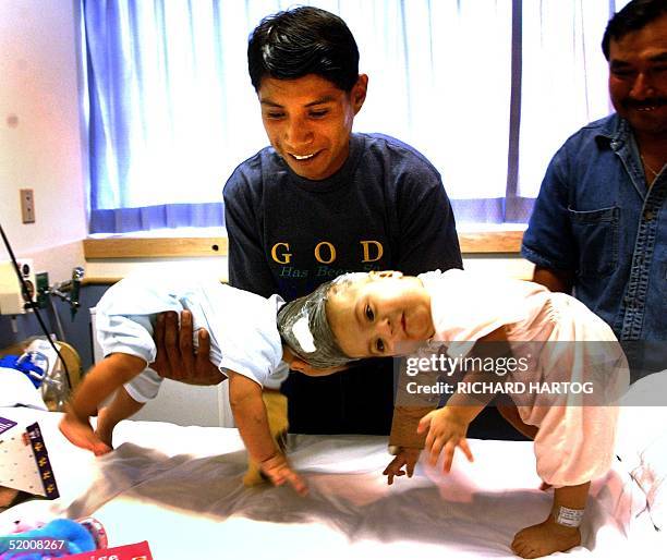 Proud father, Wenceslao Quiej is all smiles as he lifts up his two conjoined twin daughters Maria de Jesus Quiej-Alvarez, and Maria Teresa...