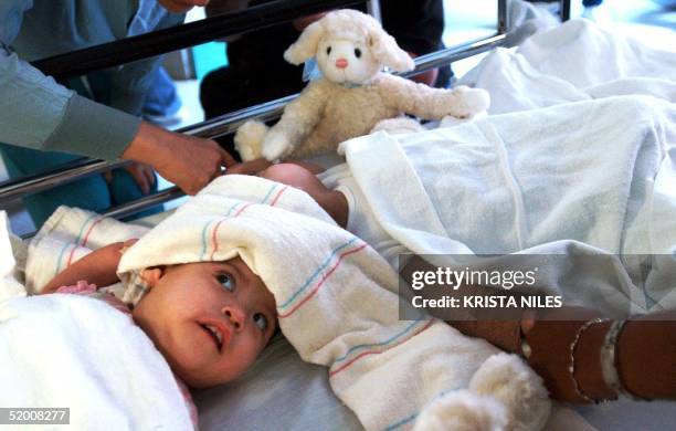 Conjoined twins Maria Teresa Quiej-Alvarez and Maria de Jesus, are comforted prior to the surgery that will attempt to separate the one-year-old...