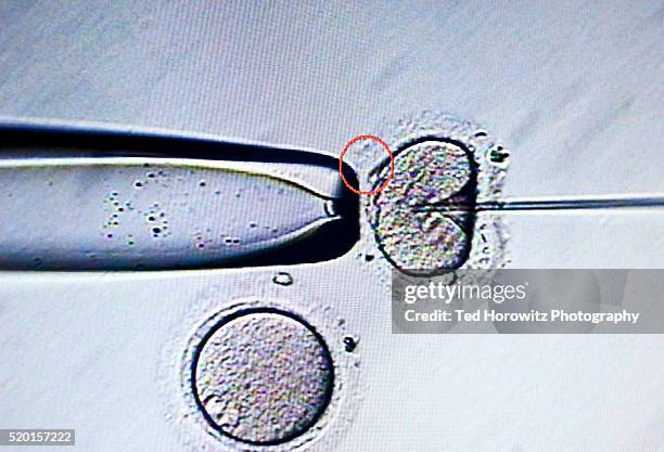 computer screen image of sperm being injected into ovum, during invitro fertilization. - in vitro fertilization stock pictures, royalty-free photos & images