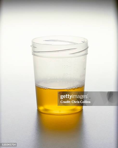 urine sample - urine stockfoto's en -beelden